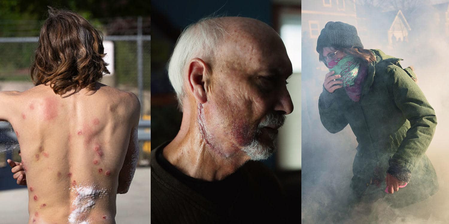 Broken bones, burning eyes: How Trump’s DHS deploys ‘less lethal’ weapons on protesters